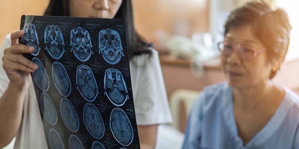 Brain disease diagnosis with medical doctor diagnosing elderly ageing patient neurodegenerative illness problem seeing Magnetic Resonance Imaging (MRI) film for neurological medical treatment