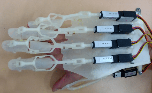 Finger Orthosis